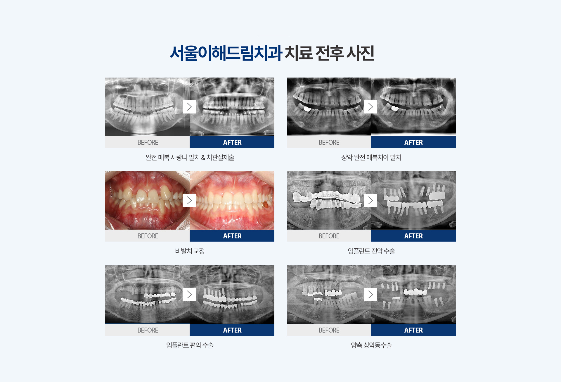 치료전후사진