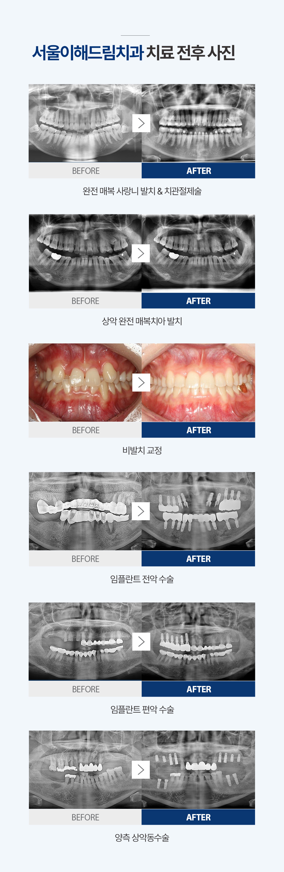 치료전후사진